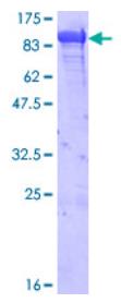 SDS-PAGE (HSPA5-5107H).jpg